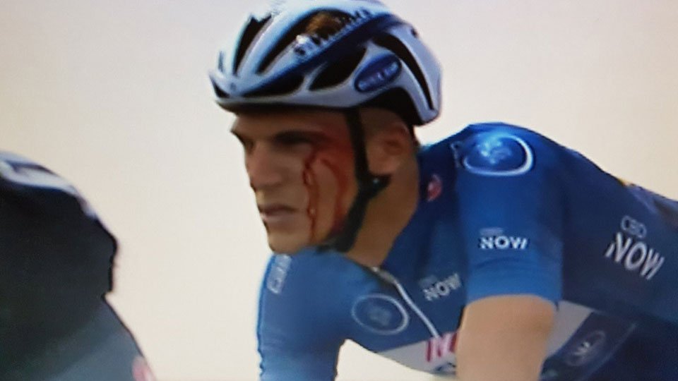 Kittel colpito al volto